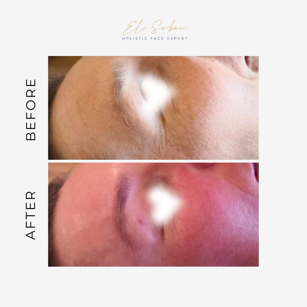 Buccal Face Massage by Eli Sobon - group course